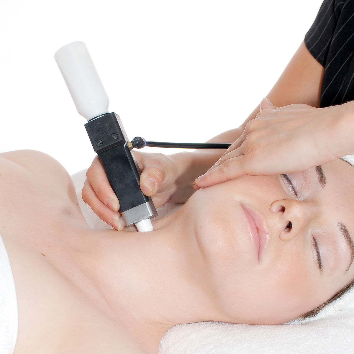 Microdermabrasie